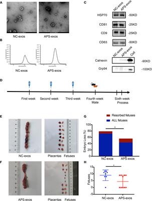 Exosome-Contained APOH Associated With Antiphospholipid Syndrome